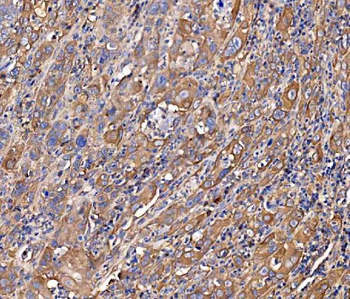 Anti-SCRN1 Antibody