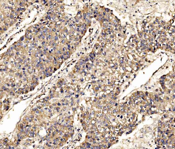 Anti-SCRN1 Antibody