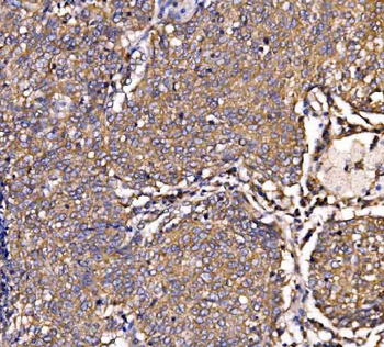 Anti-SCRN1 Antibody