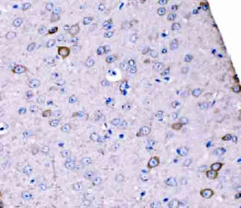Anti-SCRN1 Antibody