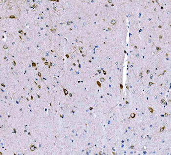 Anti-SCRN1 Antibody