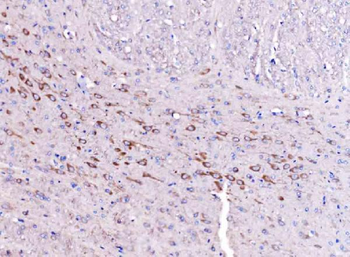 Anti-SCRN1 Antibody