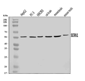 Anti-SCRN1 Antibody