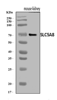 Anti-SLC5A8 Antibody