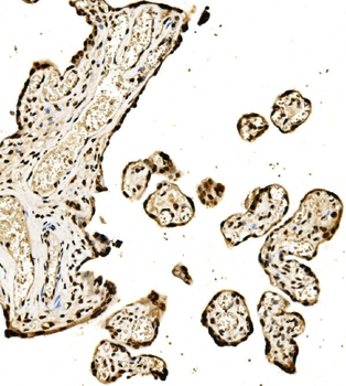 Anti-SPHK1 Antibody