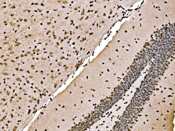 Anti-SPHK1 Antibody