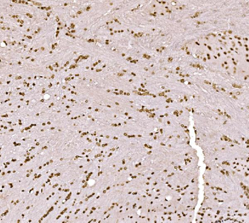 Anti-SPHK1 Antibody