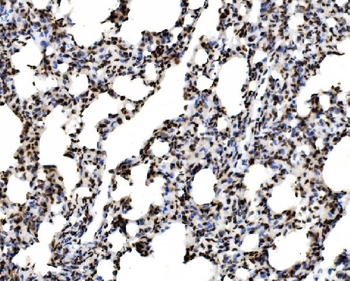 Anti-SPHK1 Antibody
