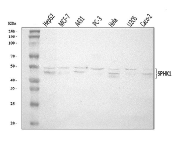 Anti-SPHK1 Antibody