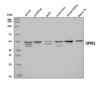Anti-SPHK1 Antibody