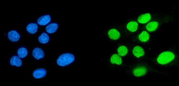 Anti-SPHK1 Antibody