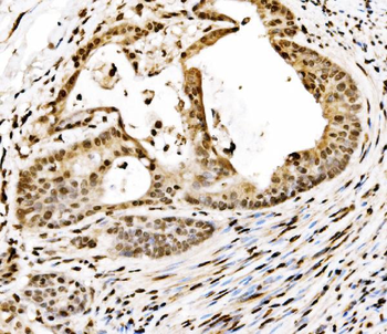 Anti-SPHK1 Antibody
