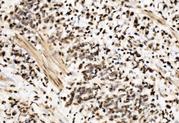 Anti-SPHK1 Antibody
