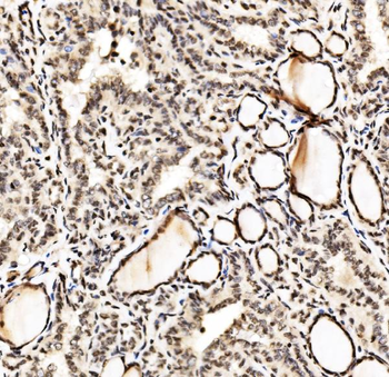 Anti-SPHK1 Antibody