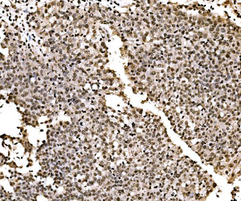 Anti-SPHK1 Antibody