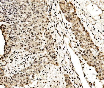 Anti-SPHK1 Antibody