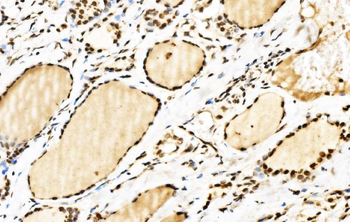 Anti-SPHK1 Antibody