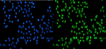Anti-SSB Antibody