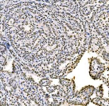 Anti-SSB Antibody