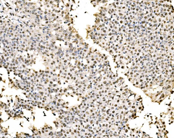Anti-SSB Antibody
