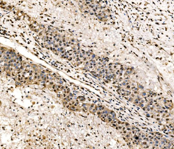 Anti-SSB Antibody