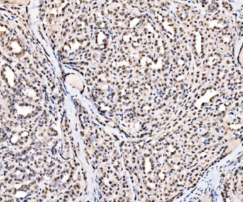 Anti-SSB Antibody