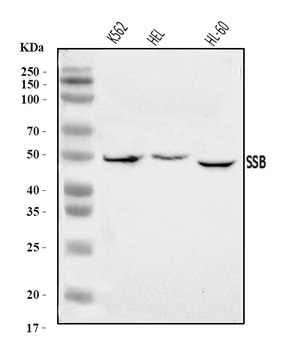 Anti-SSB Antibody