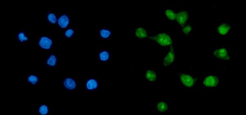 Anti-TAF8/TBN Antibody