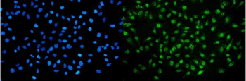 Anti-NIRF Antibody (monoclonal, 6B5)