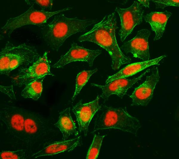 Anti-Cyclophilin E/PPIE Antibody (monoclonal, 4I9)