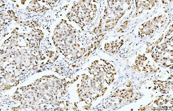 Anti-Cyclophilin E/PPIE Antibody (monoclonal, 4I9)