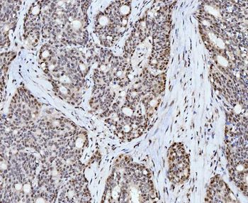 Anti-Cyclophilin E/PPIE Antibody (monoclonal, 4I9)
