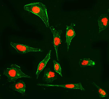 Anti-Cyclophilin E/PPIE Antibody (monoclonal, 7F2)