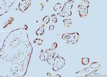 Anti-Cyclophilin E/PPIE Antibody (monoclonal, 7F2)