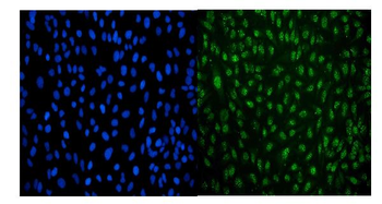 Anti-LSM8 Antibody (monoclonal, 6B11)