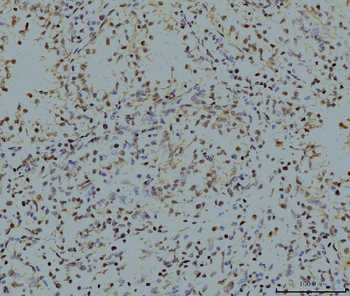 Anti-LSM8 Antibody (monoclonal, 6B11)