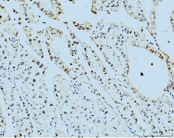 TBP-1/PSMC3 Antibody (monoclonal, 4D3)