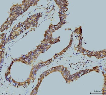 Anti-TBP-1/PSMC3 Antibody (monoclonal, 4D3)