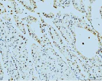 Anti-TBP-1/PSMC3 Antibody (monoclonal, 4D3)