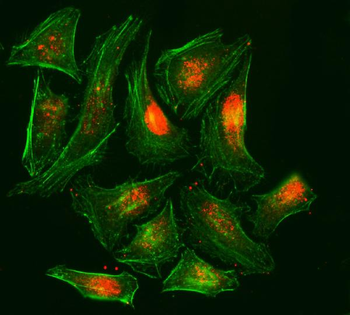 Anti-RPA32/RPA2 Antibody (monoclonal, 3B2E9)