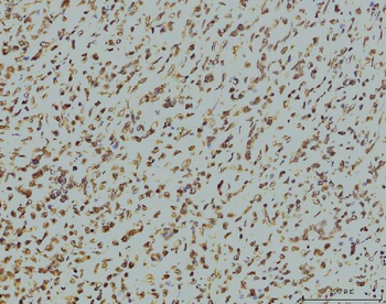 Anti-RPA32/RPA2 Antibody (monoclonal, 3B2E9)