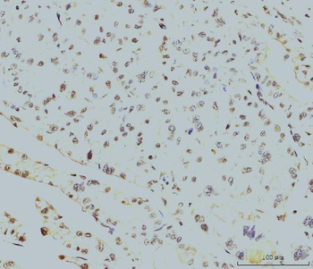Anti-RPA32/RPA2 Antibody (monoclonal, 3B2E9)