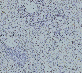 Anti-RPA32/RPA2 Antibody (monoclonal, 3B2E9)