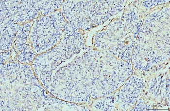 Annexin VI Antibody (monoclonal, 4C4)