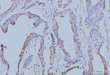 Anti-EIF4A1 Antibody (monoclonal, 3F11)