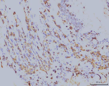 Anti-EIF4A1 Antibody (monoclonal, 3F11)