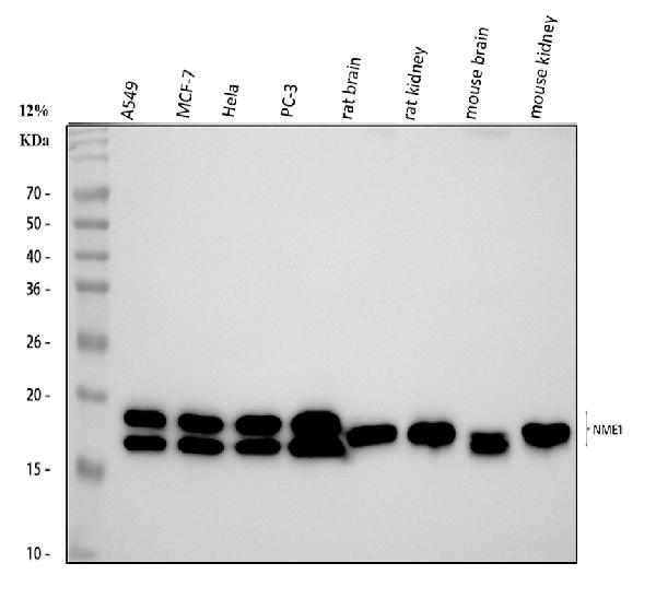 NM23A/NME1 Antibody