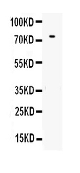 Transferrin/TF Rabbit Polyclonal Antibody