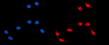 Anti-ADRM1/ARM-1 Antibody