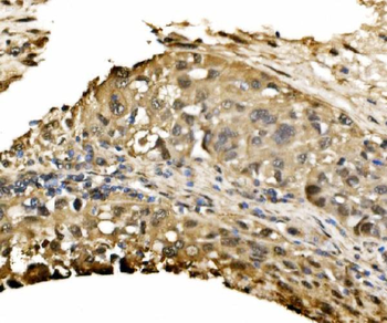 Anti-ADRM1/ARM-1 Antibody